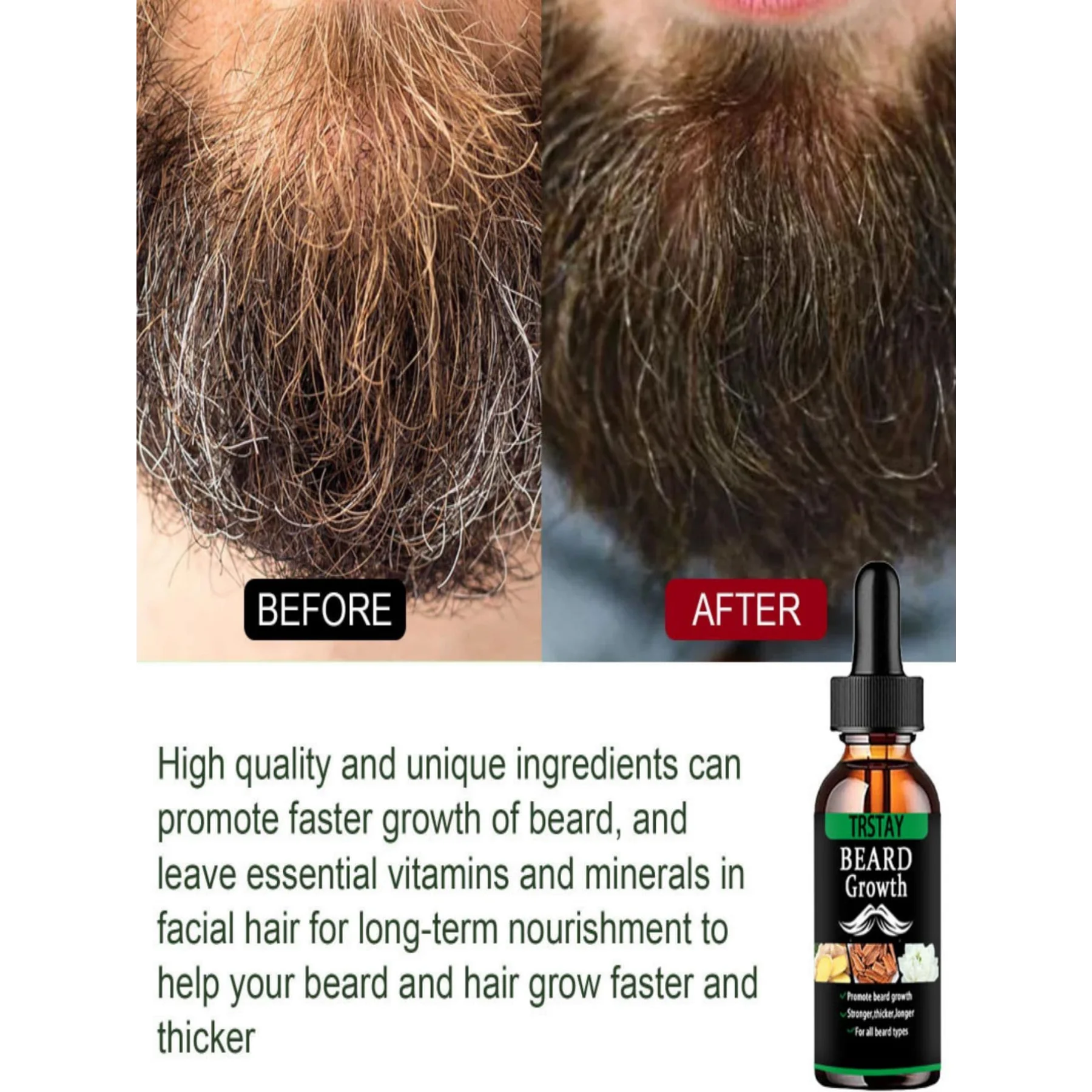 Ginger Beard Growth Essential Oil Facial Hair Thicker Faster Anti-hair Loss Products Follicles Nourish Enhancer Men Beard Care