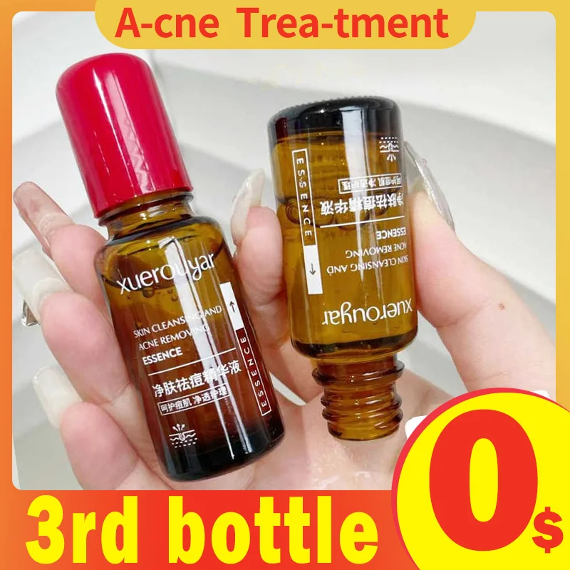 

2% Salicylic Acid Acne Face Essence Pores Shrinking Beauty Glow Recipe Skincare Whiten Serum Smooth Skin Care exfoliate Products