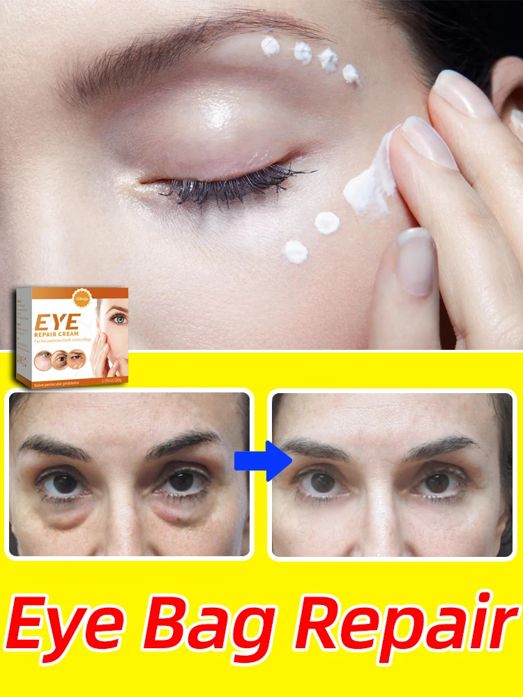 

Eye Cream Solve Various Eye Problems