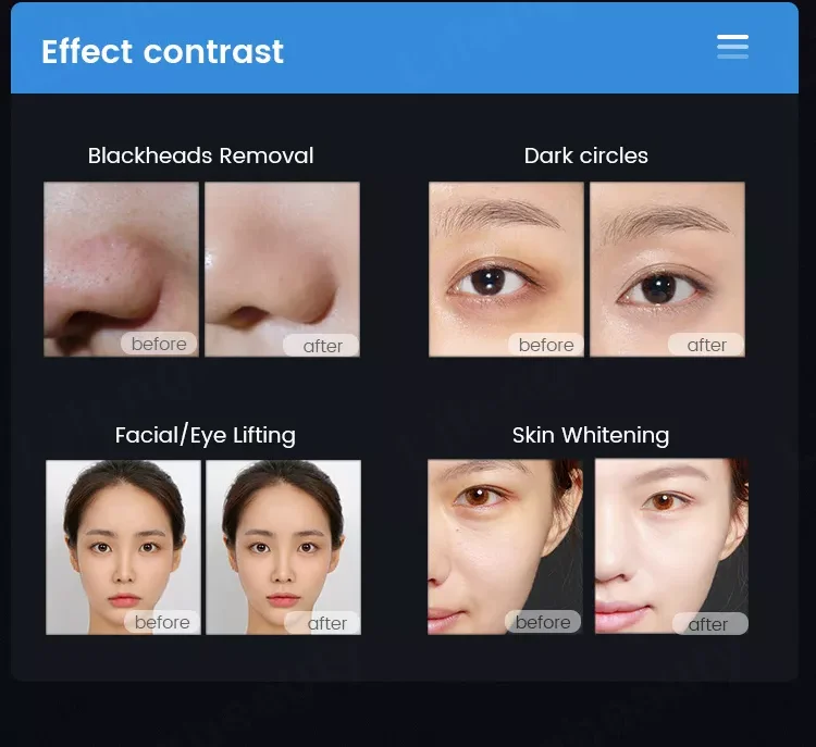 Máquina de cuidado Facial multifunción de oxígeno y agua a precio de fábrica, máquina de salón de martillo frío y caliente con elevación de iones galvánicos