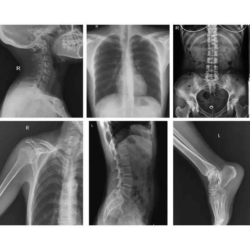 Veterinary X-ray For Pet Animal Portable Ray Equipment Vet Machine