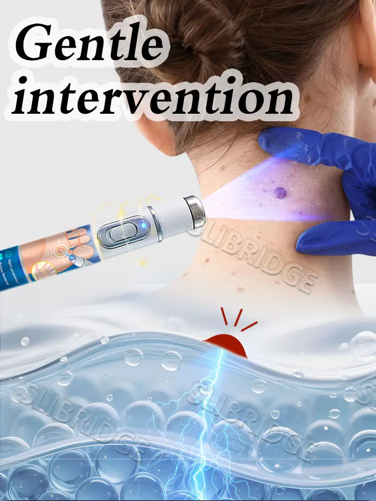 blue light pen solve warts, New Upgrade wart care tools,2025 hot sale,unisex,More discounts on sets