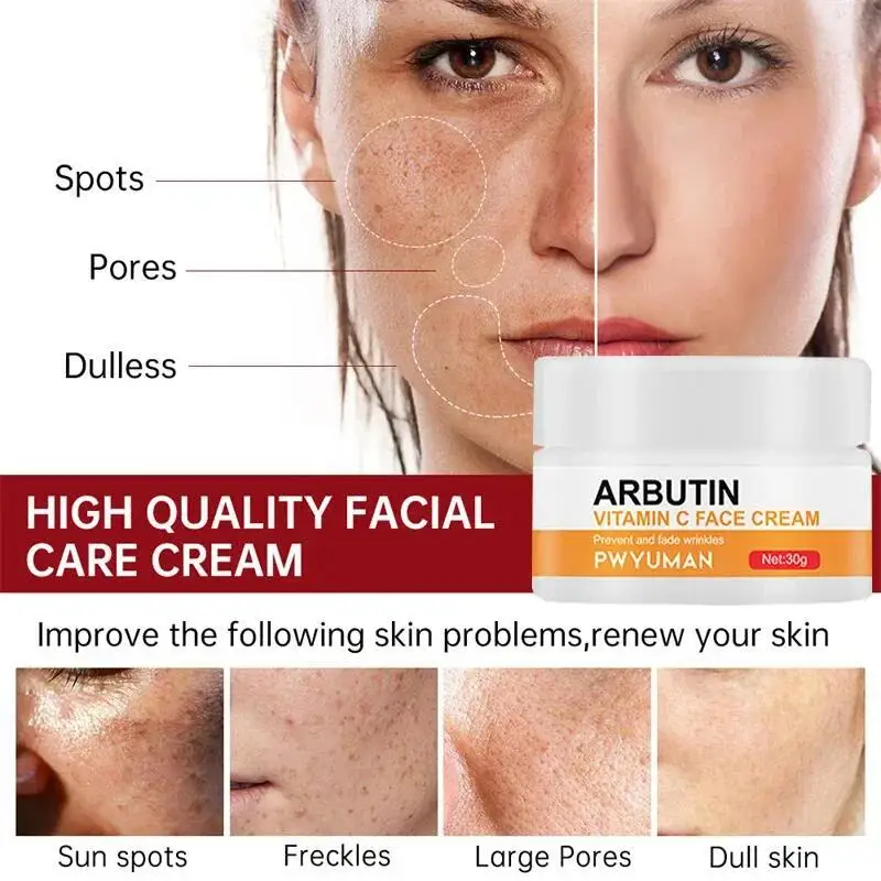 Vitamina c clareamento sardas creme remover manchas escuras melasma niacinamida clarear melanina anti-envelhecimento iluminar produtos de cuidados com a pele