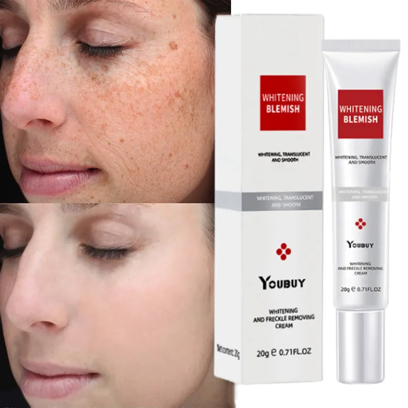 Whitening Freckle Cream Effective Remove Melasma Cream Remove Dark Spots Melanin Moisturize Brighten Smooth Face Skin Care