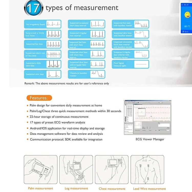 Viatom PC-80B Portable ECG Monitor Handheld LCD Heart Rate Tracker Single Leads ECG Health ECG Machine With Analyzer