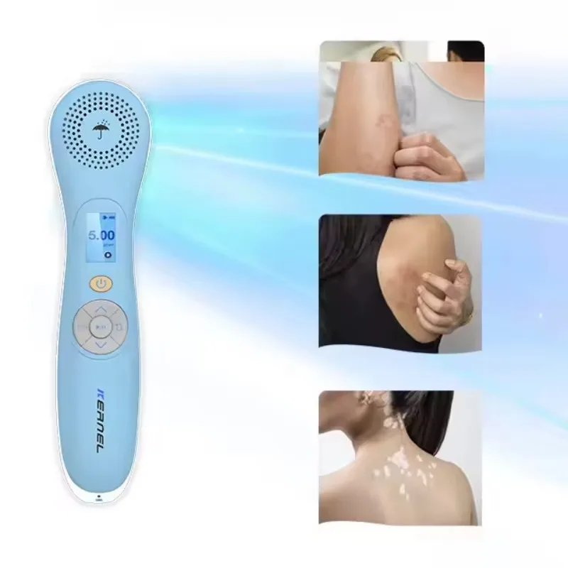 Portable 308nm LED Excimer Phototherapy Device for Face Body Vitiligo Psoriasis Eczema Treatment