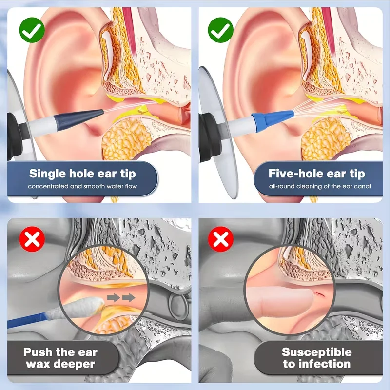 Thumbnail 4 - #48 Waxing Kits List of Top Picks