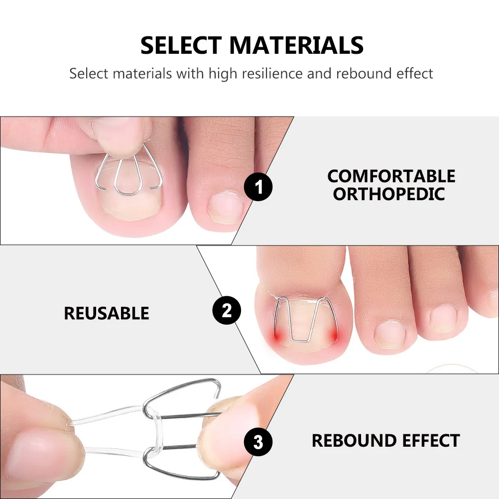 

1 Set Toe Corrector For Ingrown Nail Pain Relief Paronychia Care Tool Nail Groove Pedicure Device Lightweight Travel
