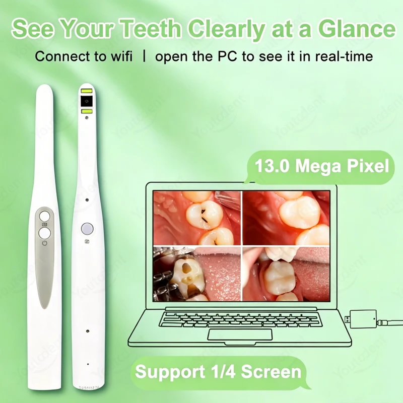 Wireless WIFI Dental Intraoral Camera 13MP HD 1080p Oral Inspection Camera 8 LED Auto Focus USB Dentistry Endoscope For Computer