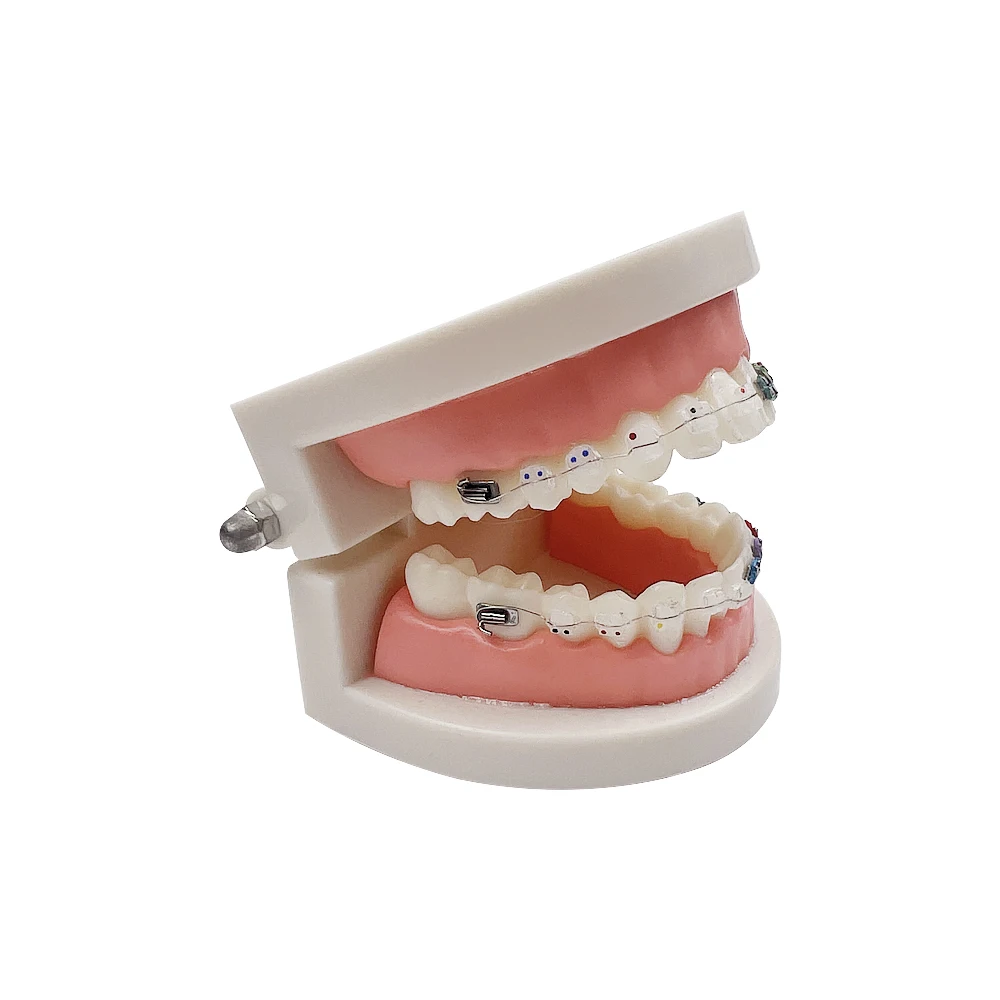Dental Orthodontic Teeth Model with Metal Wires and Bracket Adult Standard Denture Mouth Model Dental Display Teaching Model