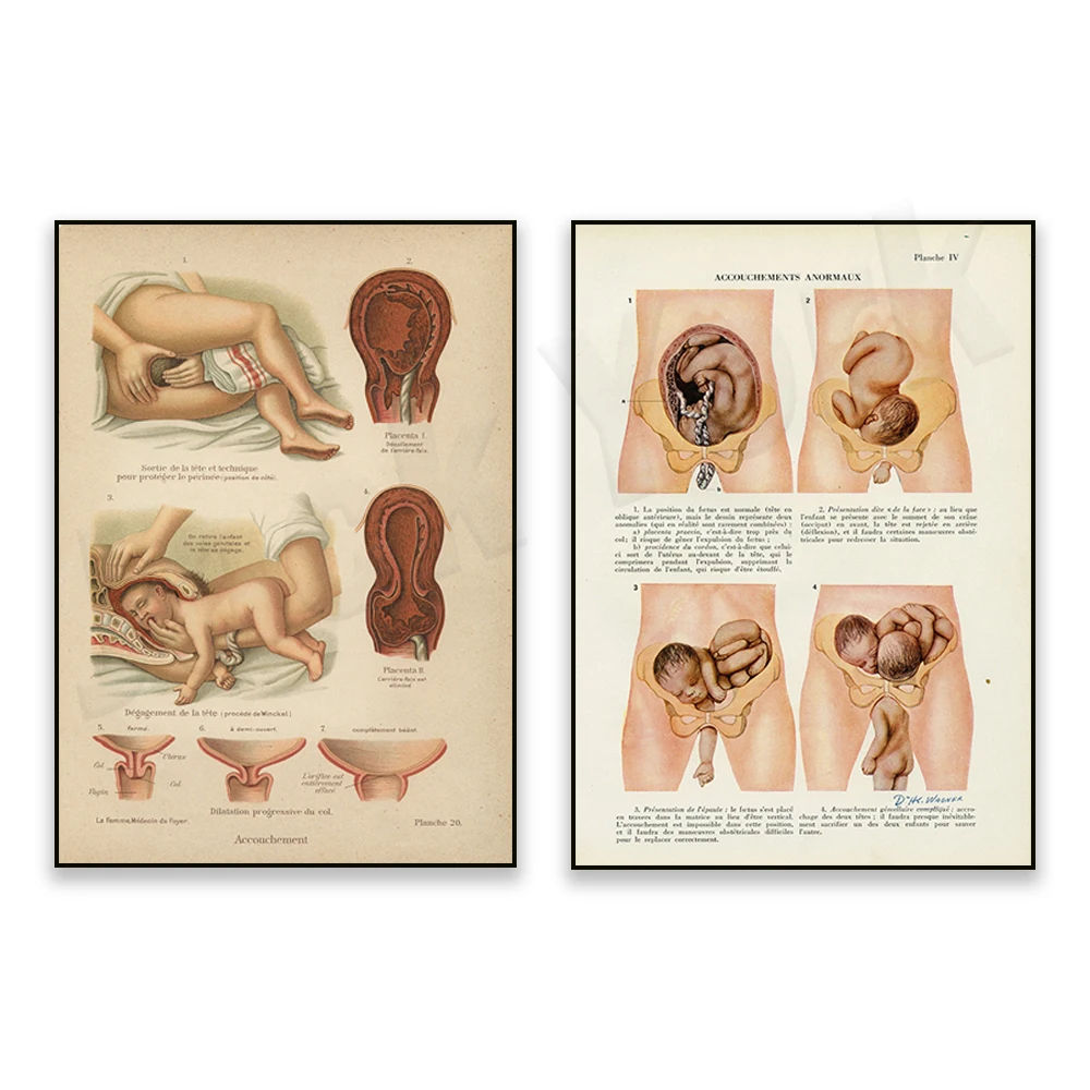 

French anatomy print, baby uterus medical gift for gynecologist, doctor poster for midwife nurse, medical student. midwife
