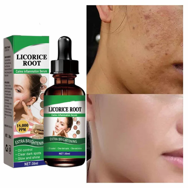 Licorice Whitening Serum lightens Spots Brightens Freckles Melanin Corrector Moisturizes And Smooths Skin Care Facial Serum