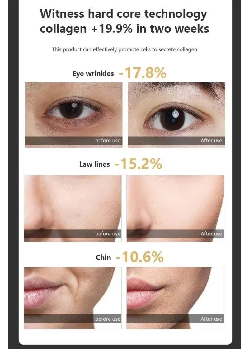 Machine de beauté du visage à 7 avantages de base, radiofréquence, raffermissement de la peau, équipement de beauté à lumière rouge EMS pour Anti-rides