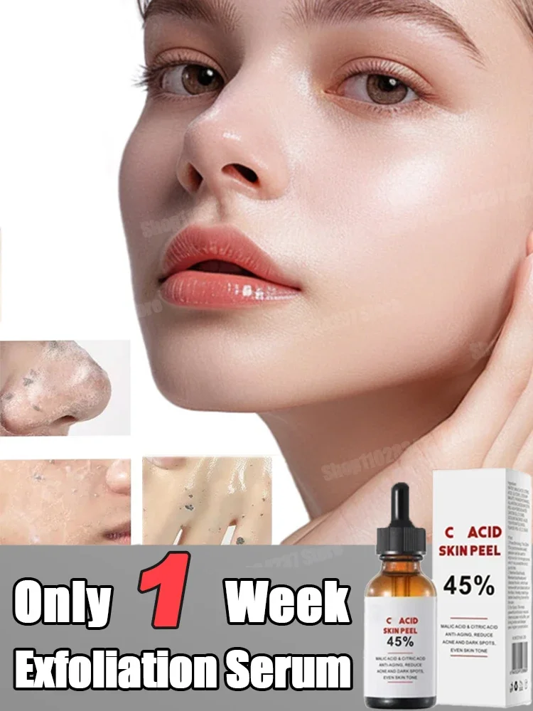 Exfoliating Peeling Oil Chemical Peel Pigmentation Lightening Melanin Acne Remove Scar Yellow Peeling Face Care Oi