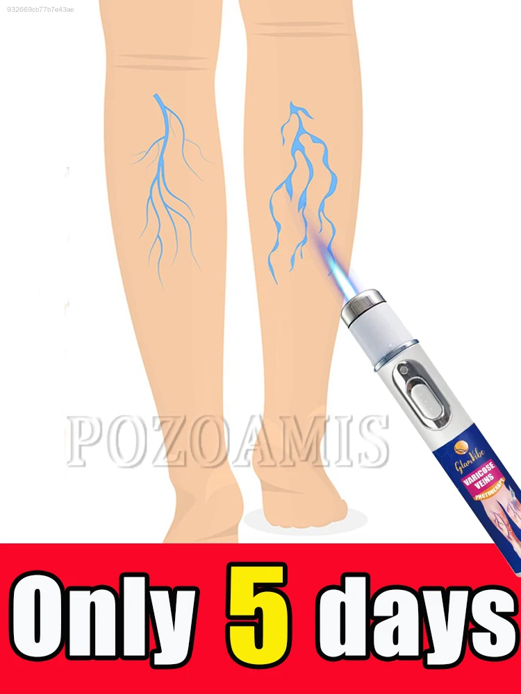 

Pay attention to leg and foot health