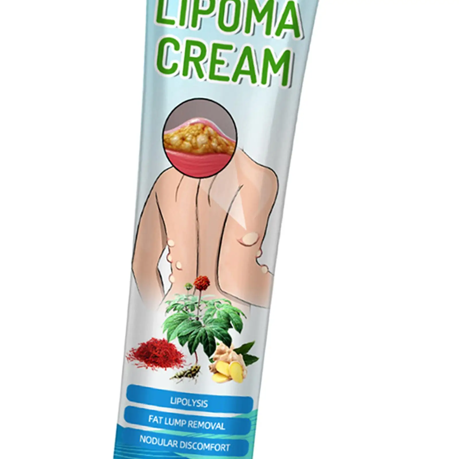 Crema per la rimozione del lipoma da 20 g, comoda da trasportare, ampia applicazione. Dispositivo per la rimozione del lipoma facile da usare