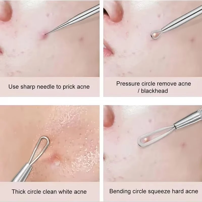 Thumbnail 4 - #39 Trending Skin Care Extractors Right Now