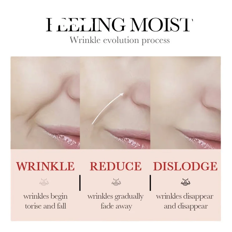 مقشر مرطب يزيل الخلايا الميتة ويقفل العناية بالرطوبة لجلد اليد الخلفي ويحسن الضيق