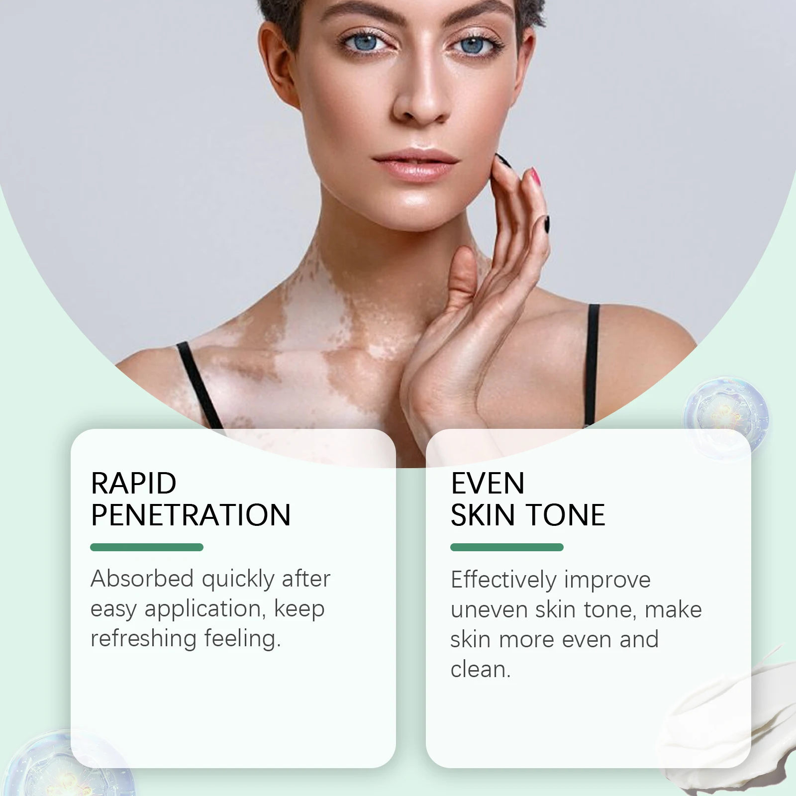 White Spots Removal Cream Repair Skin Vitiligo Enhance Melanin Even Skin Tone Prevent Spread Leukoplakia Treatment Ointment