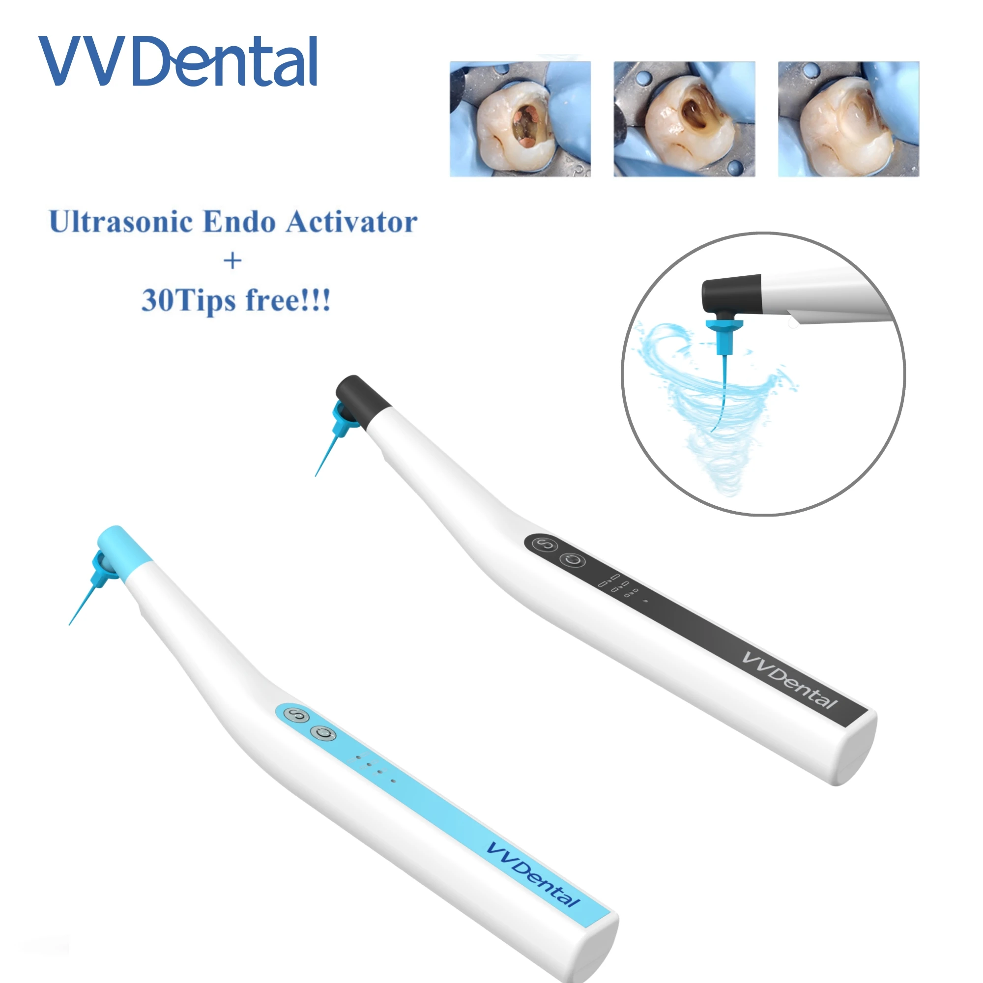 

VV Dental Root Canal Sonic Irrigator Activator+30pcs Endo Files,Battery-Powered,for Deep root canal cleaning