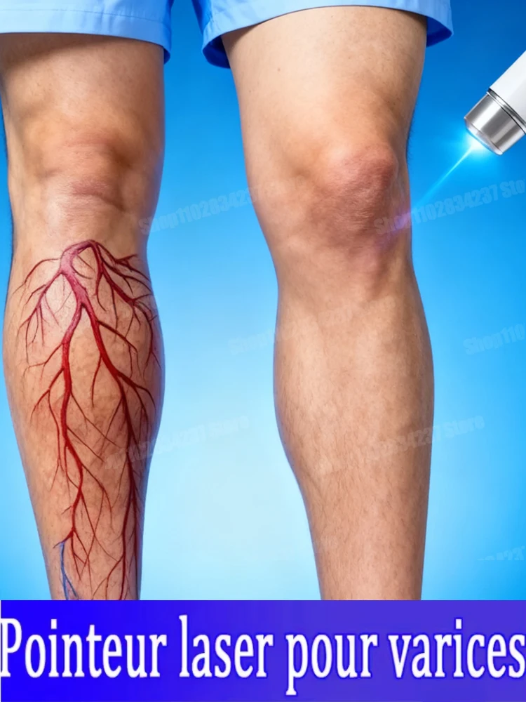 uickly 2025 НОВЫЙ унисекс инструмент с венами синего света, более скидки на наборы1