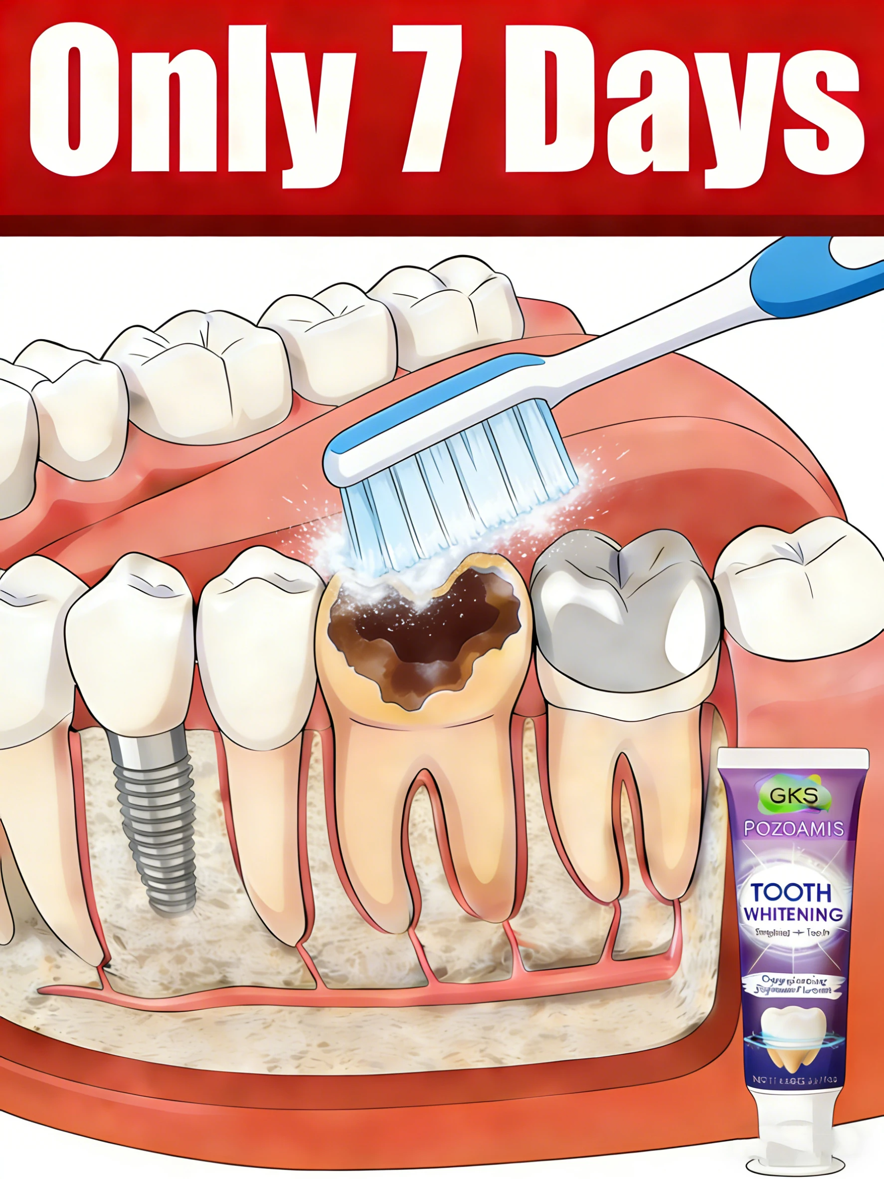 

Защитите десны и предотвратить полость.