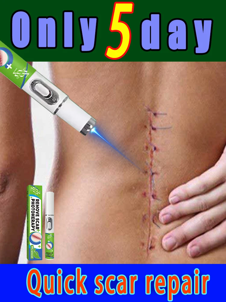 

Sᴄᴀʀ ʀᴇᴍᴏᴠᴀʟ ʟᴀsᴇʀ ᴘᴇɴ ɪs ᴜsᴇᴅ ᴛᴏ ʀᴇᴍᴏᴠᴇ ʙᴜʀɴ sᴄᴀʀs, sᴜʀɢɪᴄᴀʟ sᴄᴀʀs, sᴄʀᴀᴛᴄʜ sᴄᴀʀs, ғᴀʟʟ sᴄᴀʀs, ᴀɴᴅ ʀᴇᴘᴀɪʀ ᴏʟᴅ sᴄᴀʀs