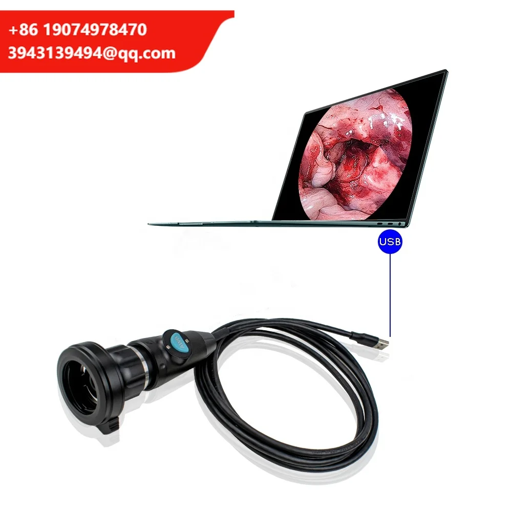 Portable USB Endoscope Camera For Medical Use Full HD CMOS Nasal Otoscope ENT Ear Laparoscopic Electric Made Metal Plastic
