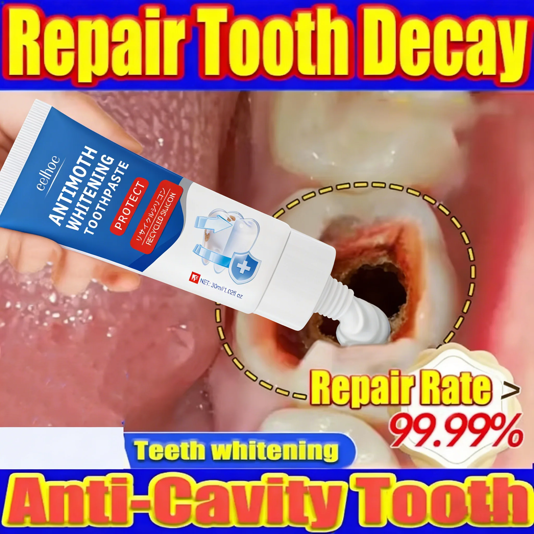 

New 2nd ᵍᵉⁿᵉʳᵃᵗⁱᵒⁿ ᵘᵖᵍʳᵃᵈᵉᵈ ᵗᵒᵒᵗh ⸴ ʳᵉpᵃⁱʳ ᵗᵒᵒᵗh ʳᵒoᵗ ⸴ ᑫᵘⁱᶜᵏˡʸ