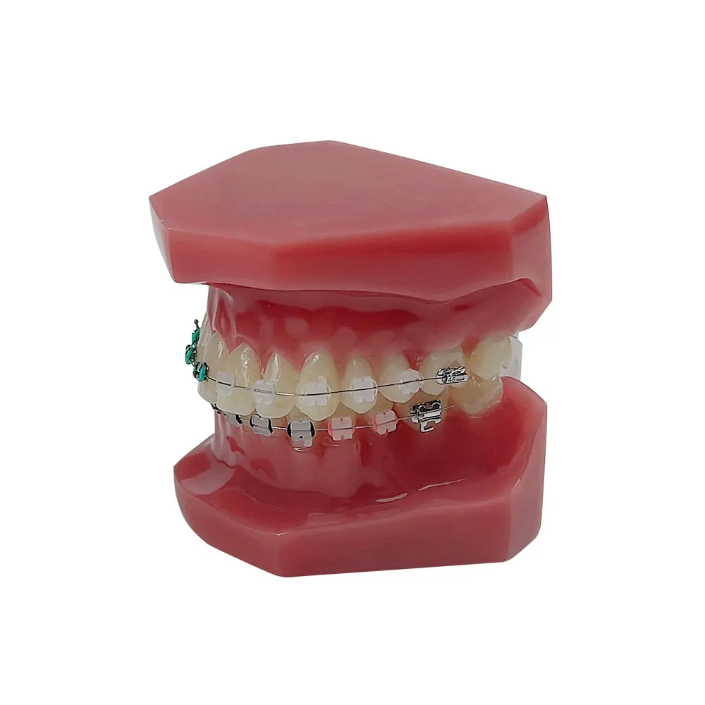 Normal Dental Orthodontic Teeth Model With Brace Half Metal Half Ceramic Standard Teaching Model Dental Teeth Model For Studying