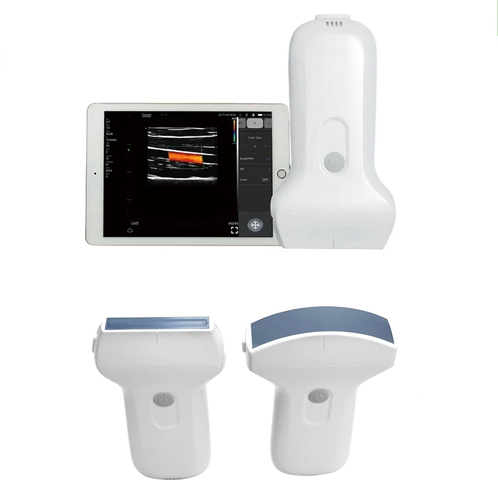 Upgrade USB And Wifi Double Mode Color Doppler Wireless Ultrasound Scanner Convex Linear Probe