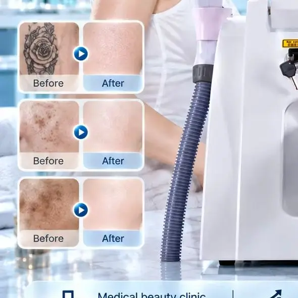 IPL OPT Laser Beauty Equipment 2 In 1 ND YAG Freezing Point Painless Hair Removal Tattoo Eyebrow Freckle Removal Machine