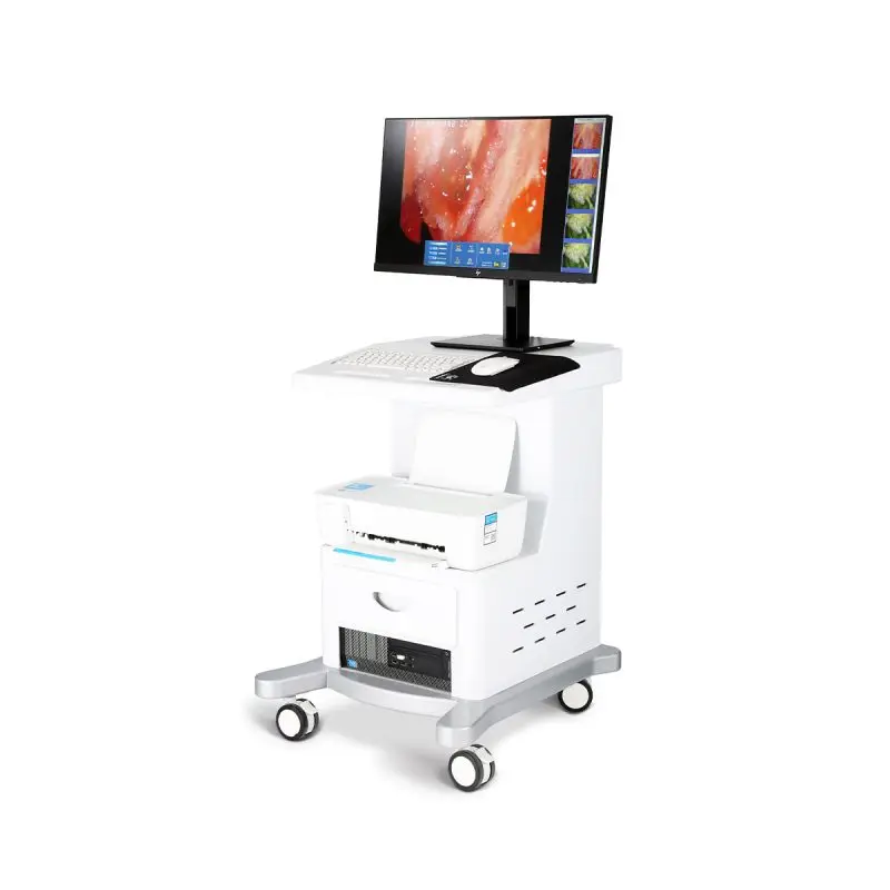 Electronic colposcopy, high definition, electronic colposcopy, reproductive gynecological examination, endoscope