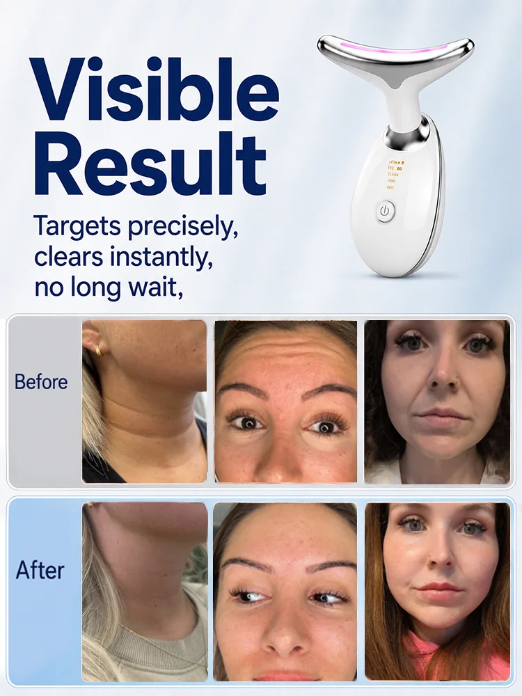 Face And Neck Wrinkle Remover  - Health Wellness Massage review and price