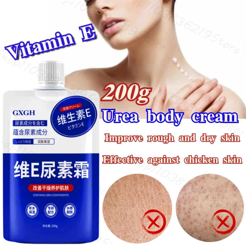 

Vitamin E urea cream to improve rough chicken skin deep moisturizing anti-dry body can use moisturizing lotion 200g