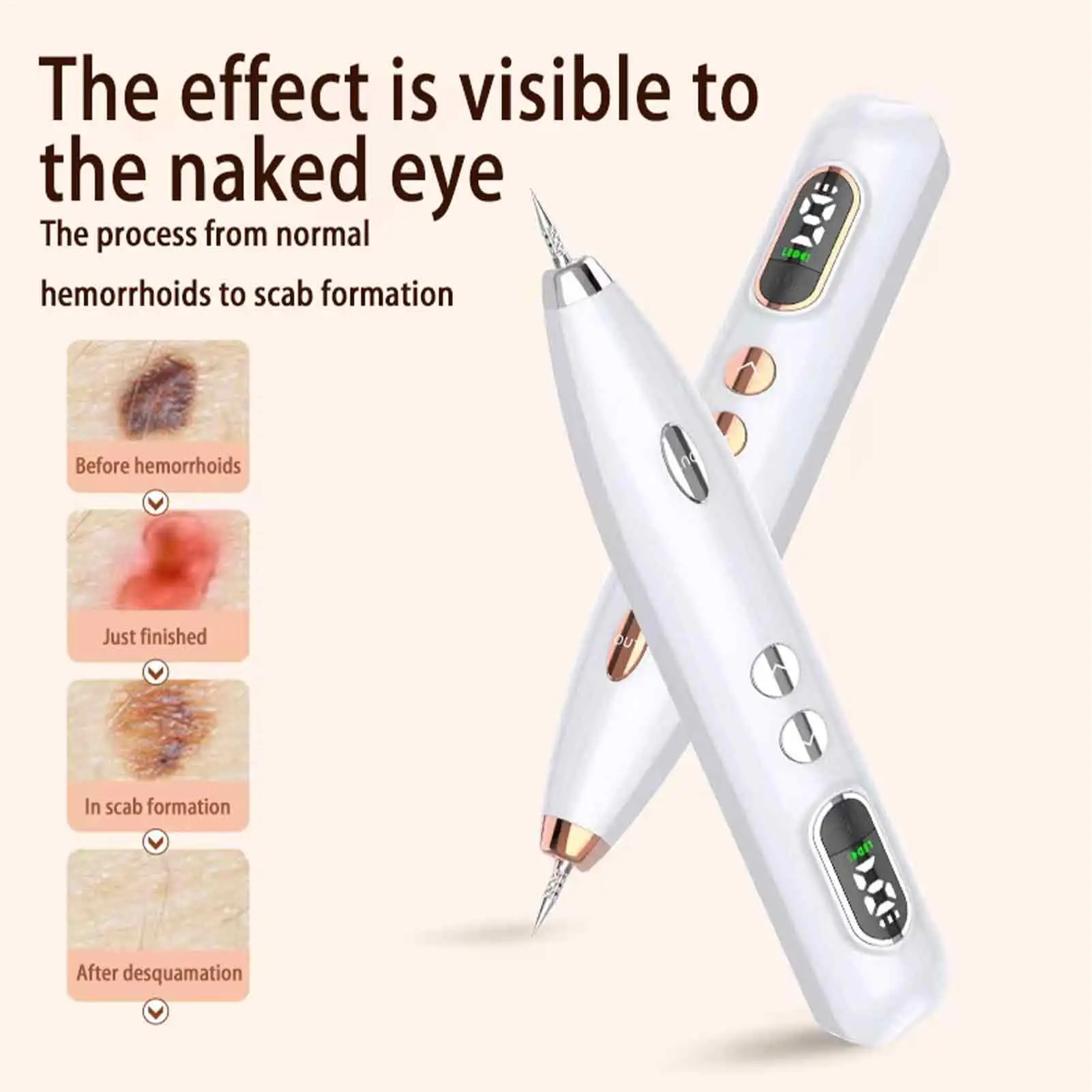 USB Charge Electronic Face Skin Scar Removal Pens Repairing Skin Machine For Dark Spot Birthday Dating Gift For Friends Neighbor