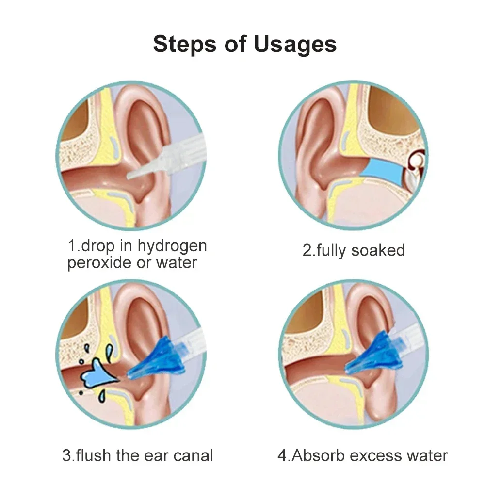 طقم مزيل شمع الأذن للبالغين والأطفال ، فوهات الأذن ، منظف الأذن الحلزوني ، زجاجة مياه الري البلاستيكية ، العناية بالأذن ، أدوات سلامة الغسيل