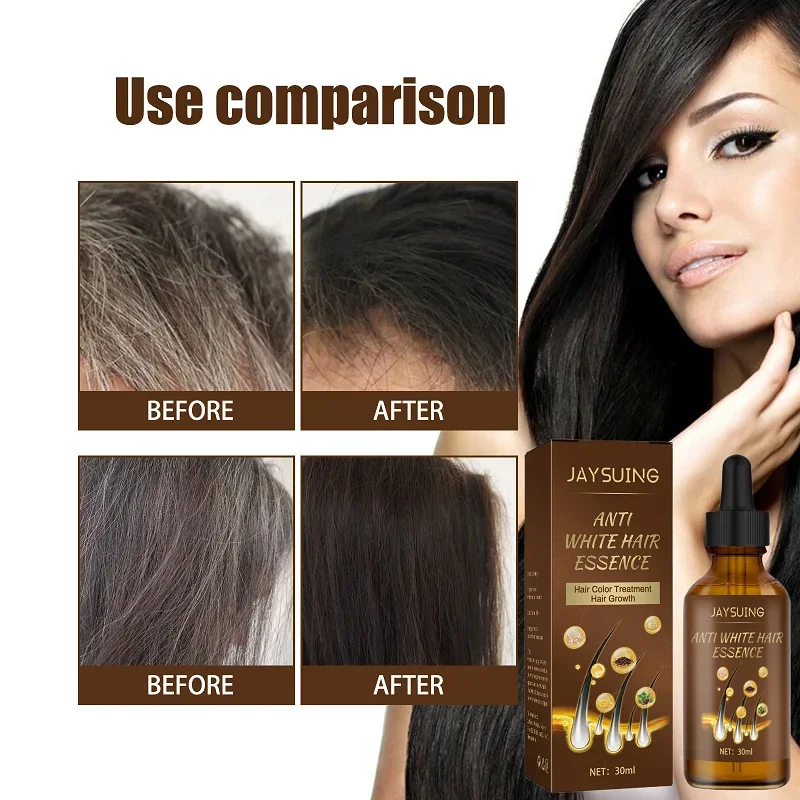 

30ml Jaysuing Anti-White Hair Essence Black Hair Essence Scalp Massage Hair Moisturizing Growth Liquid Essence Hairs Products