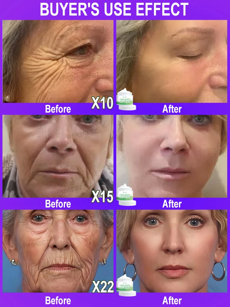 ไม่มีริ้วรอย อายุน้อยกว่า 20 ปี หน้าเต็มตัว