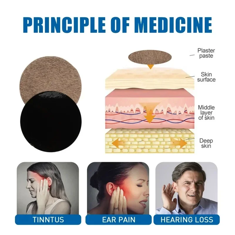 Parche de tratamiento de Tinnitus de 12 piezas para aliviar el dolor, pegatina para la pérdida de audición, extracto de hierbas naturales, yeso para el cuidado de la salud