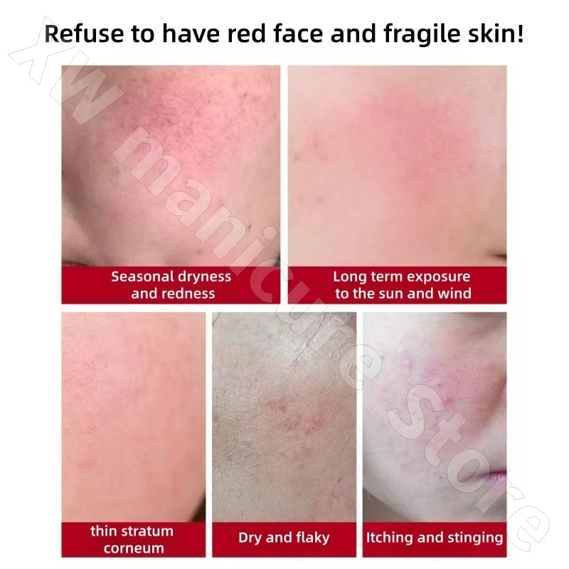 كريم إكدوين لإصلاح احمرار البشرة وتحسن البشرة الحساسة ويكثف ويرطب البشرة الرقيقة كريم سيراميد 30 جرام