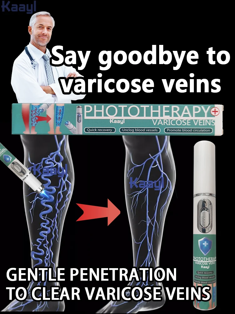 

Varicose vein laser pointer