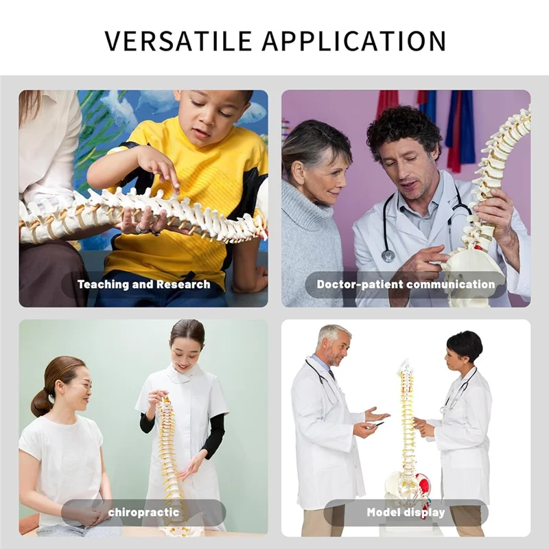 Modelo de columna vertebral para anatomía, arterios, columna Lumbar, faja Pelvic Fémur con soporte para estudio científico o educación del paciente