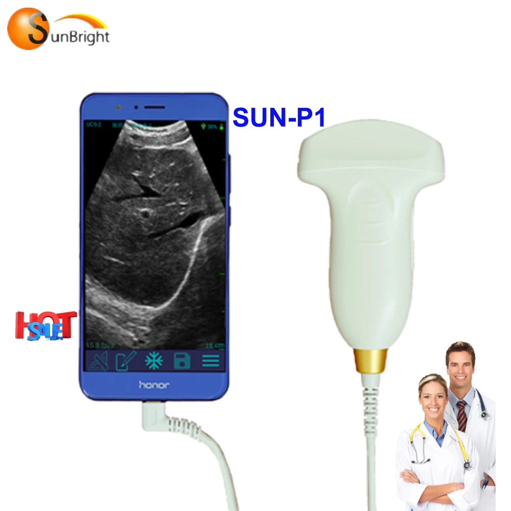 

2.5-10Mhz wireless USB probe Mini ultrasound device