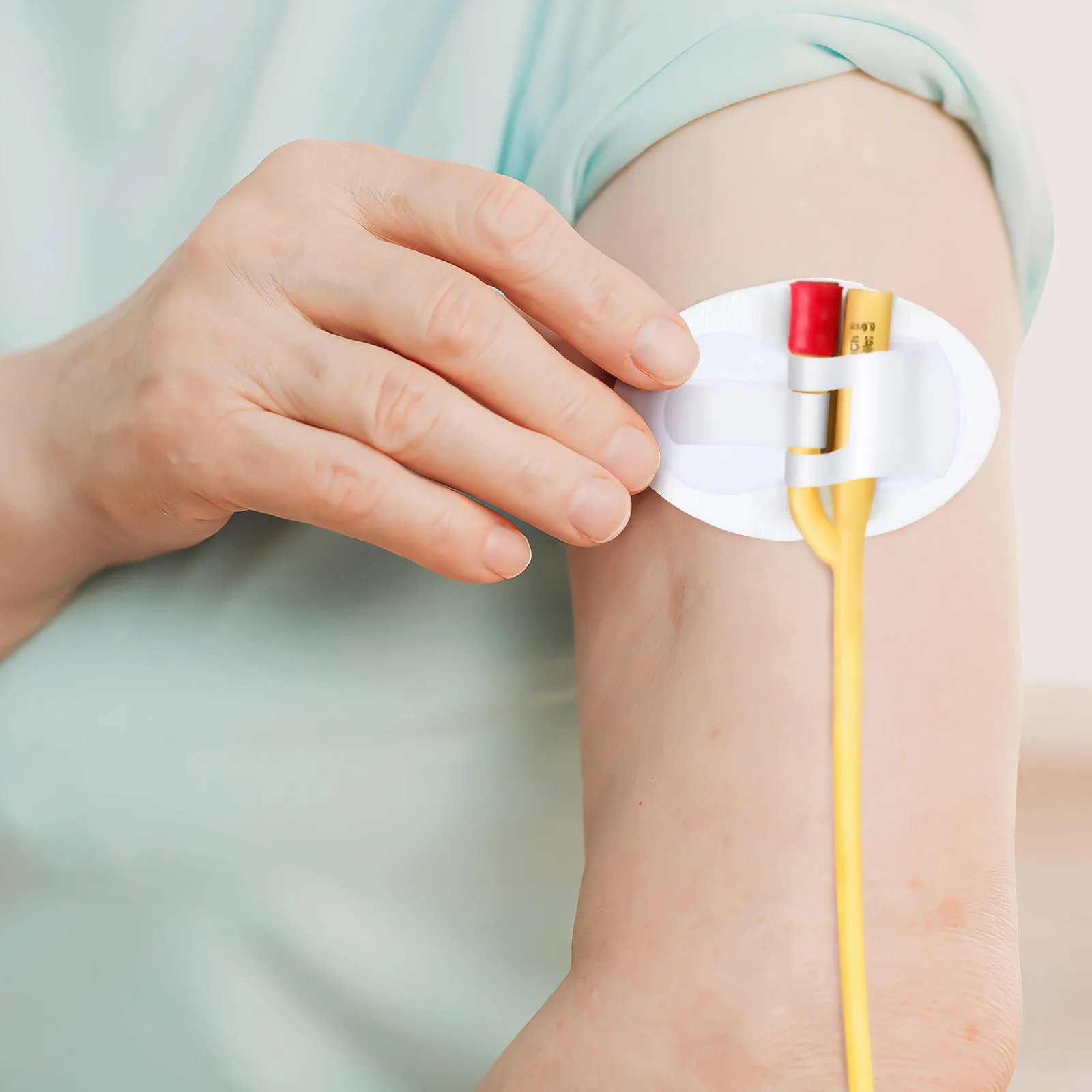 

4 шт., универсальные наклейки для катетера, бежевые, простые в использовании держатель трубки, стабилизирующее устройство, экономия времени, фиксирующие ленты для трубок