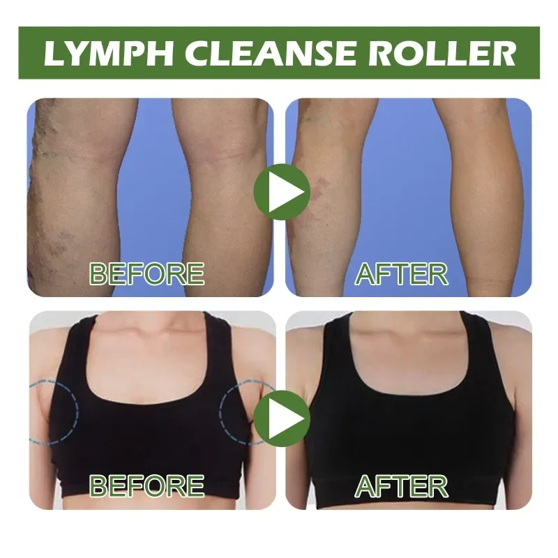 Lymph Drainage cleaning roller relieve swelling discomfort in neck leg armpits Lymphatic Detox body massage Health care Tools