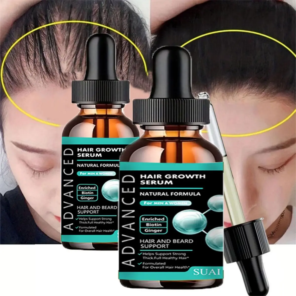 Crescimento do cabelo para homens ferramenta de crescimento de óleo essencial reparação do cabelo proteção furcation cuidados com o crescimento do