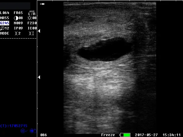 Wh-57 Veterinary Ultrasound For Animal Ecografo Portatil Portable Wireless Ultrasound Machine Price