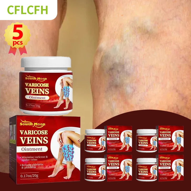 Crema para tratamiento de venas varicosas, 5 piezas, cuidado de los pies, varicosidad de las piernas, angitis, Vasculitis dilatada, flebitis, medicina para aliviar