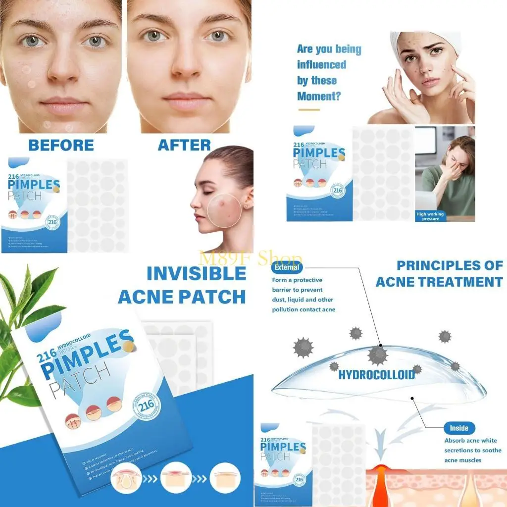 

M89F 216 шт. гидроколлоидные пластыри от прыщей, дневное и ночное использование, невидимые пластыри от прыщей, консилер,